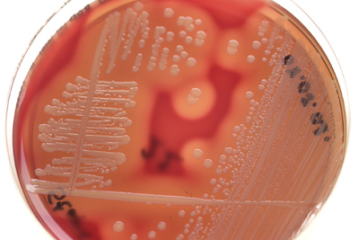 Hlt fast allen Antibiotika stand: Bakterienkultur mit multiresistentem Staphylococcus aureus (MRSA).