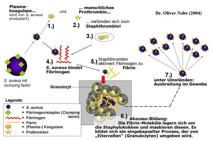 Schema: Entstehung von Abszessen und Furunkeln