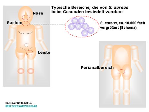 Besiedlung gesunder Keimträger durch S. aureus